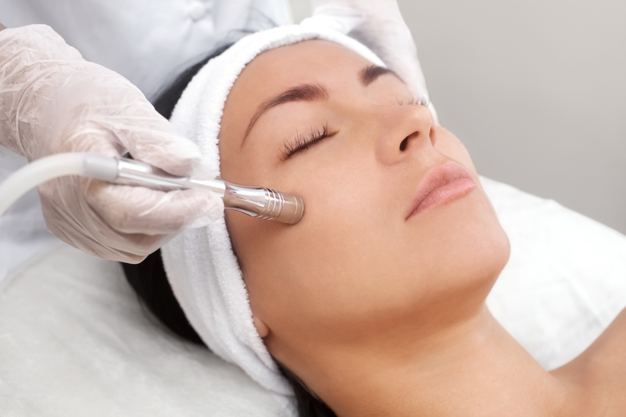 how long does microneedling take